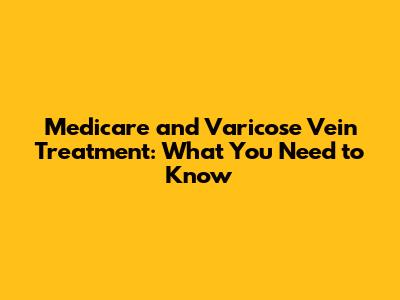Medicare and Varicose Vein Treatment: What You Need to Know