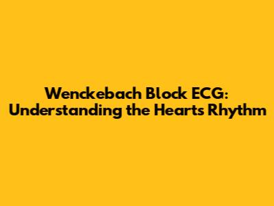 Wenckebach Block ECG: Understanding the Heart's Rhythm